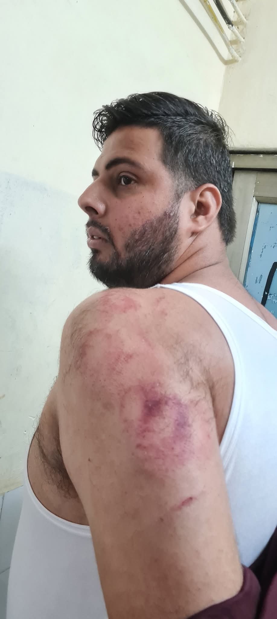 कांग्रेसी पार्षद बंटी नीलकंठ से पिटने वाले निखिल अरोड़ा की बड़ी मुश्किल